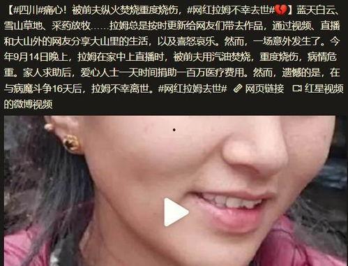 网红拉姆遭纵火烧伤,网红拉姆纵火案，网络暴力下的生命代价